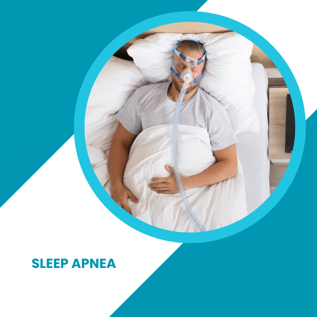 Sleep Apnea - CPAP Alternatives - ToothFeed