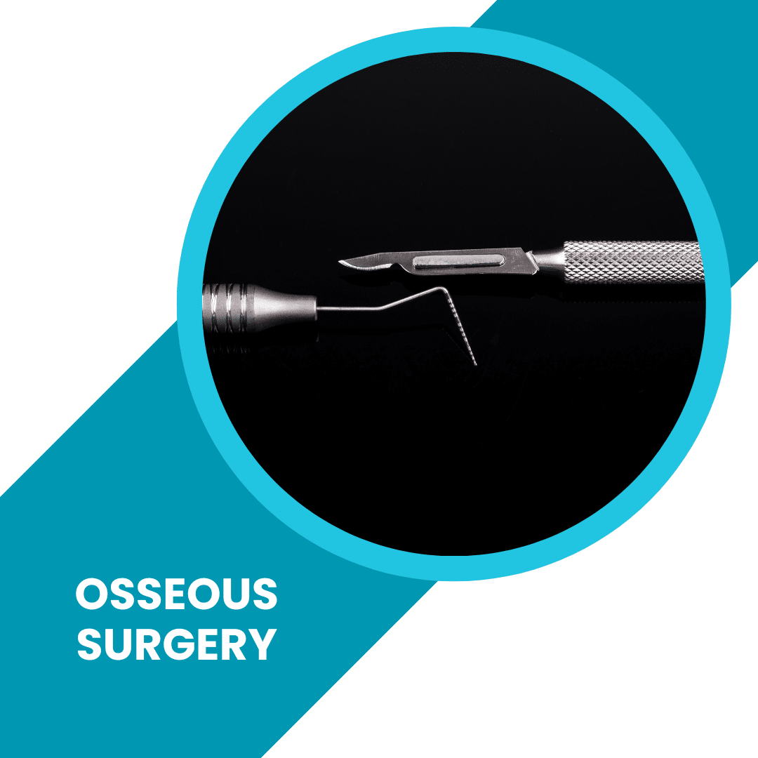 Osseous Surgery - When Is It Used And Why?