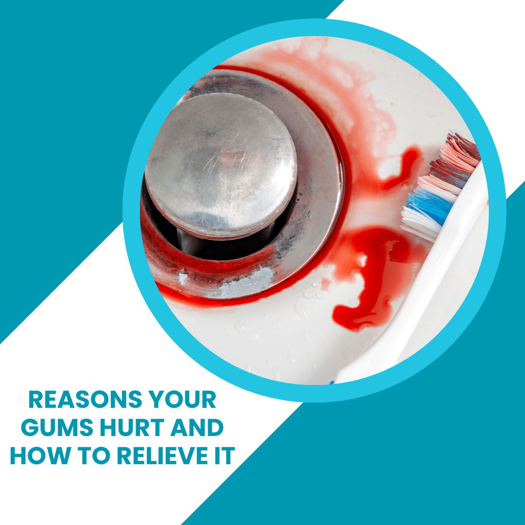 Reasons Your Gums Hurt and How to Relieve it - Better Oral Hygiene