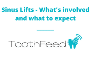 Sinus Lifts - What's Involved and What to Expect