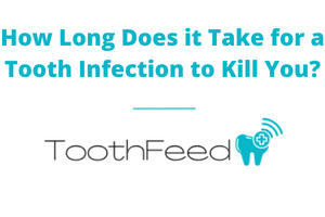 How Long Does it Take for a Tooth Infection to Kill You?