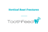 Vertical Root Fractures