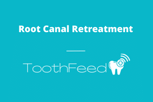 Root Canal Retreatment - ToothFeed