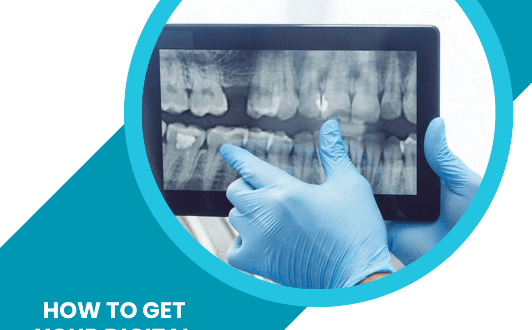 How to Get Your Digital Dental X Rays for a Second