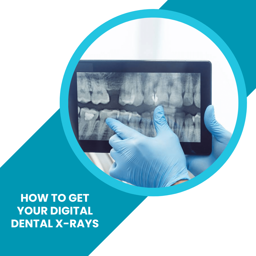 How to Get Your Digital Dental X Rays for a Second