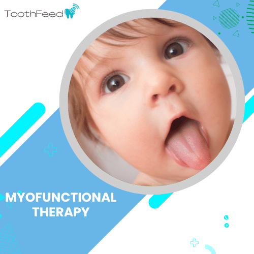 Myofunctional Therapy - Myo.Edu.Dental